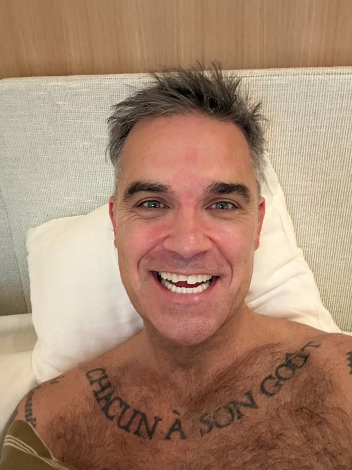Robbie Williams shows off chipped tooth Miami 2026