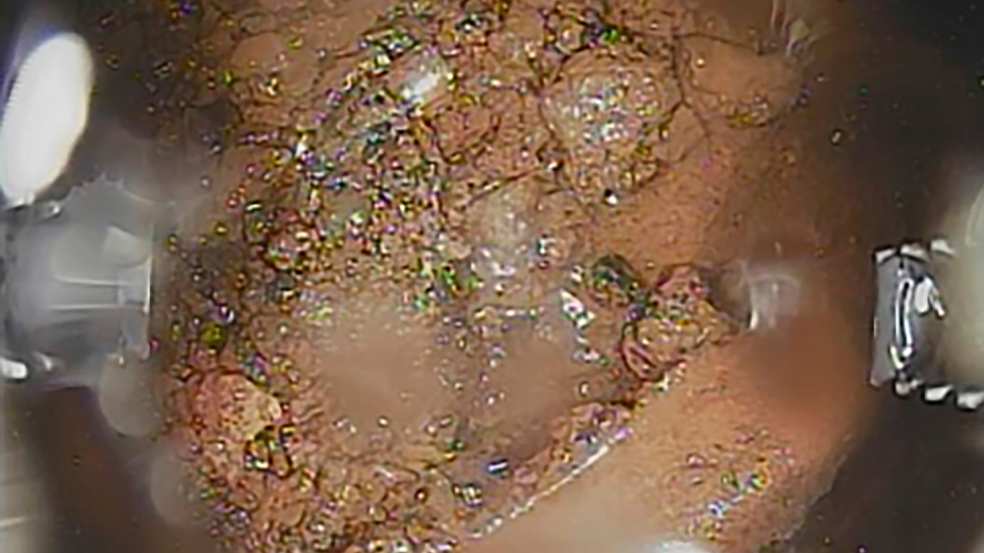 This image released by Tokyo Electric Power Co. (TEPCO), shows melted fuel taken by a telescopic robot inside of the primary containment vessel of Unit 2 reactor at the Fukushima Dai-ichi plant in Okuma, northeast Japan. (Tokyo Electric Power Co. via AP)