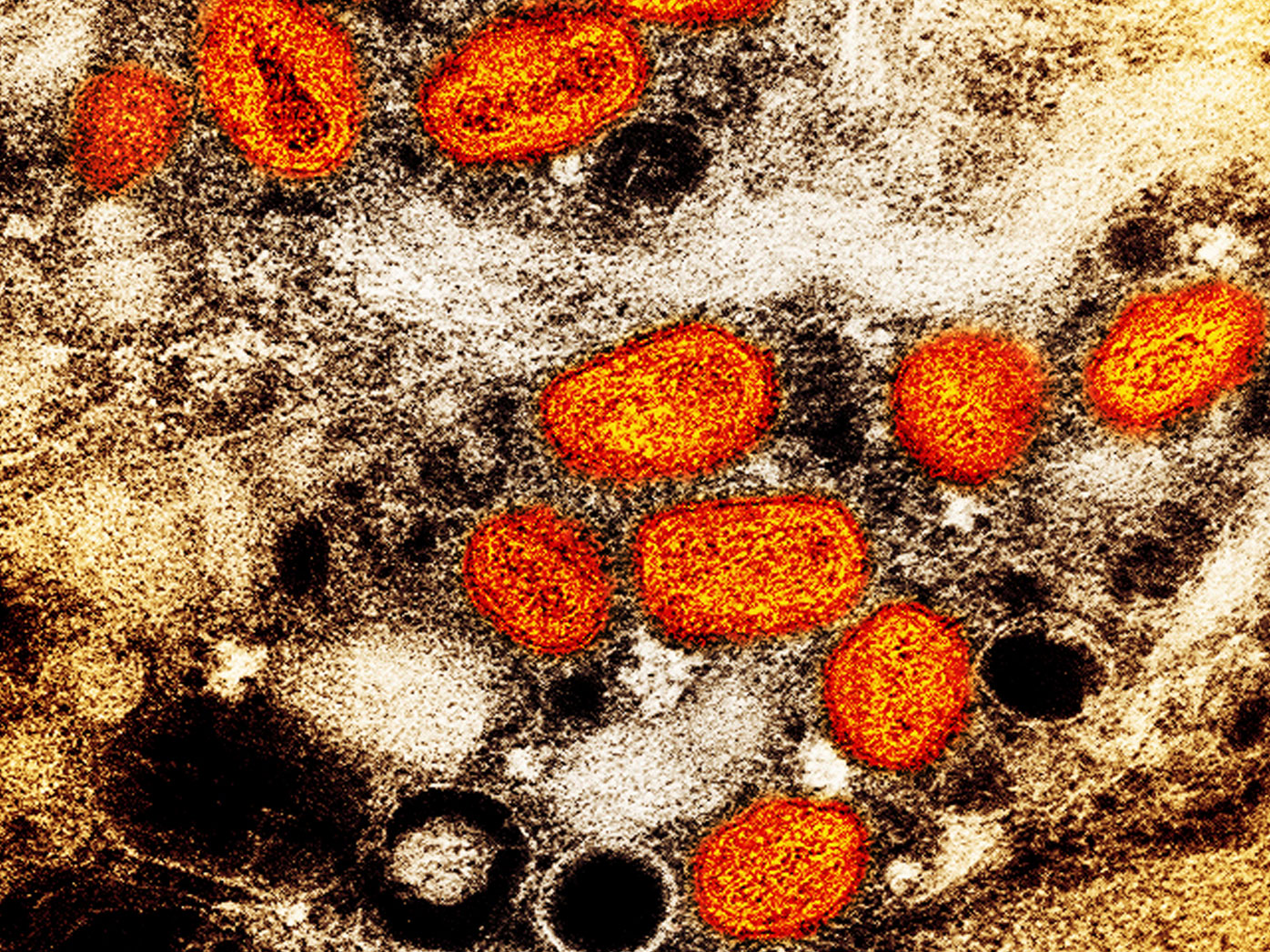 The monkeypox virus viewed through a microscope.