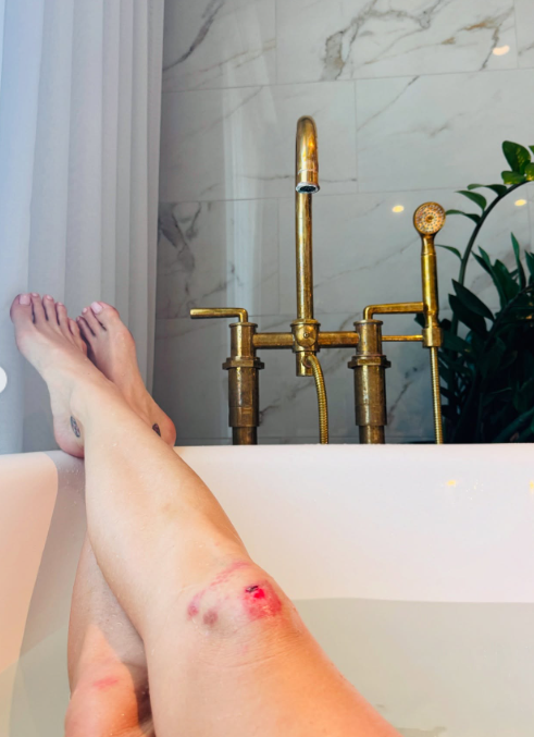 <div>Katy Perry reveals outcome of painful on-stage mishap: ‘Made me go arghh’</div>