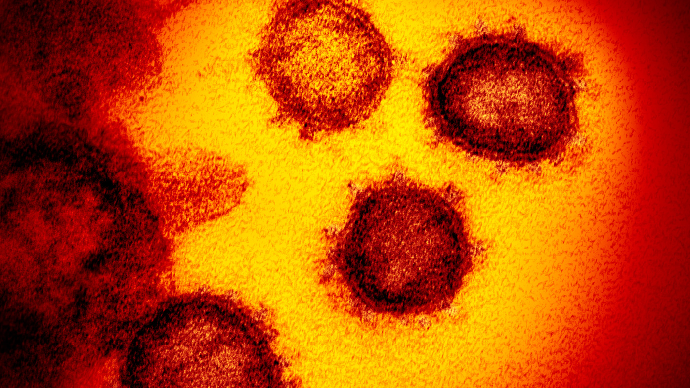 El nuevo coronavirus SARS-CoV-2, también conocido como 2019-nCoV, se muestra bajo un microscopio.  El virus causa el COVID-19. 