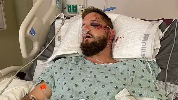 Groom Aric Hutchinson has had reconstructive surgery in hospital.