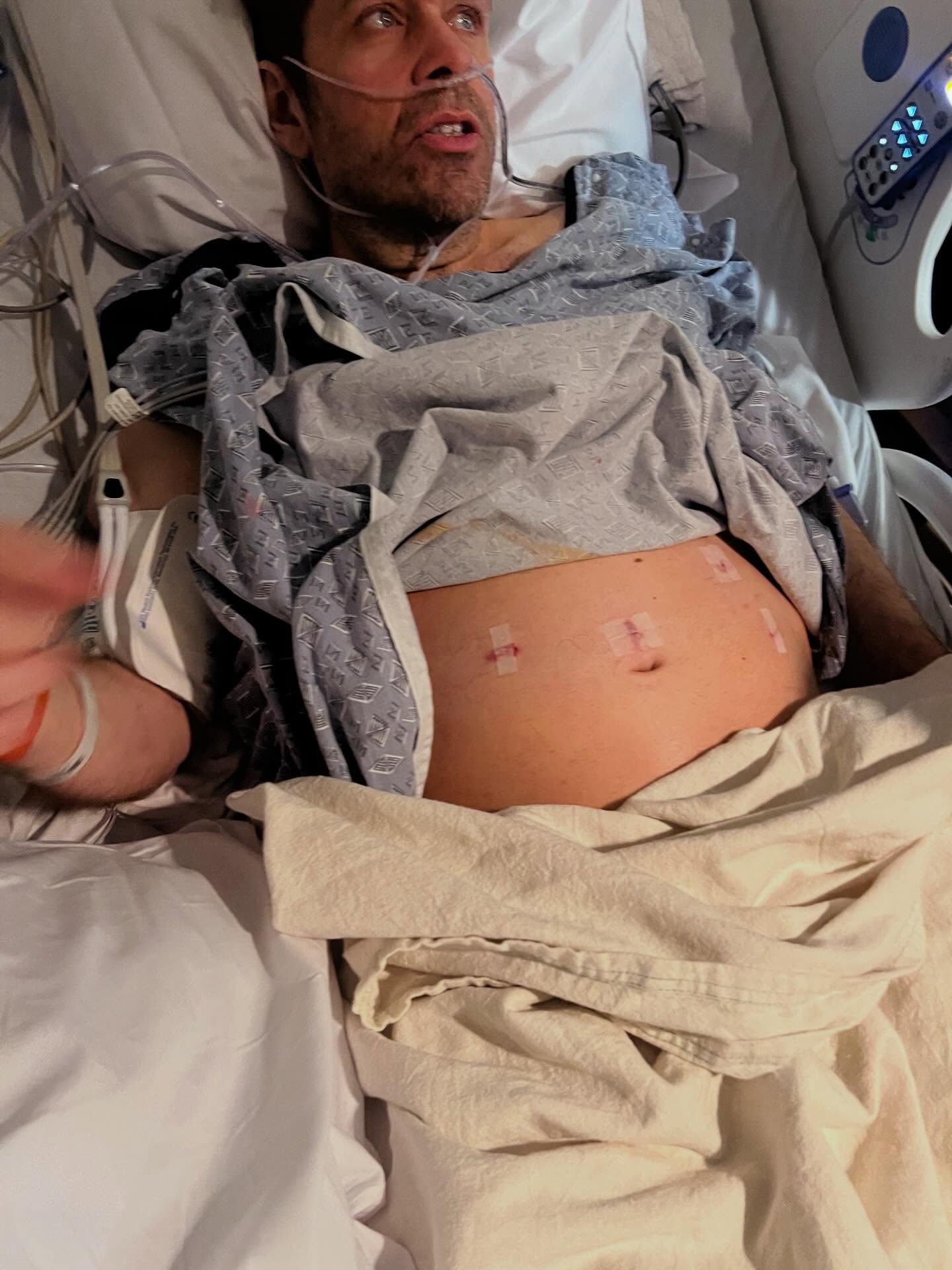 Perez Hilton shares photos from hospital bed and reveals he had the flu and sepsis