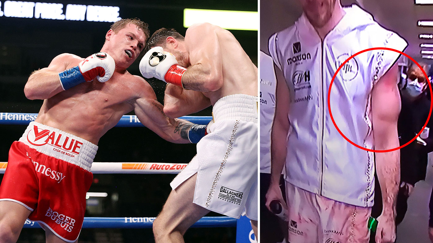 Callum Smith's left arm looks banged up 