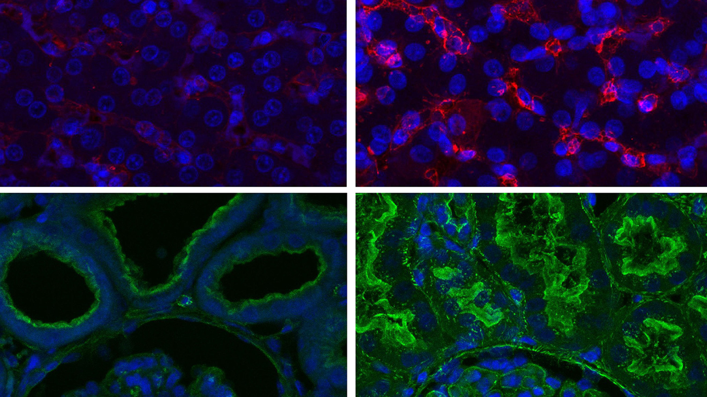 Researchers at Yale University say they have been able to restore blood circulation and other cellular functions in pigs a full hour after the animals' deaths, suggesting that cells don't die as quickly as scientists had assumed.