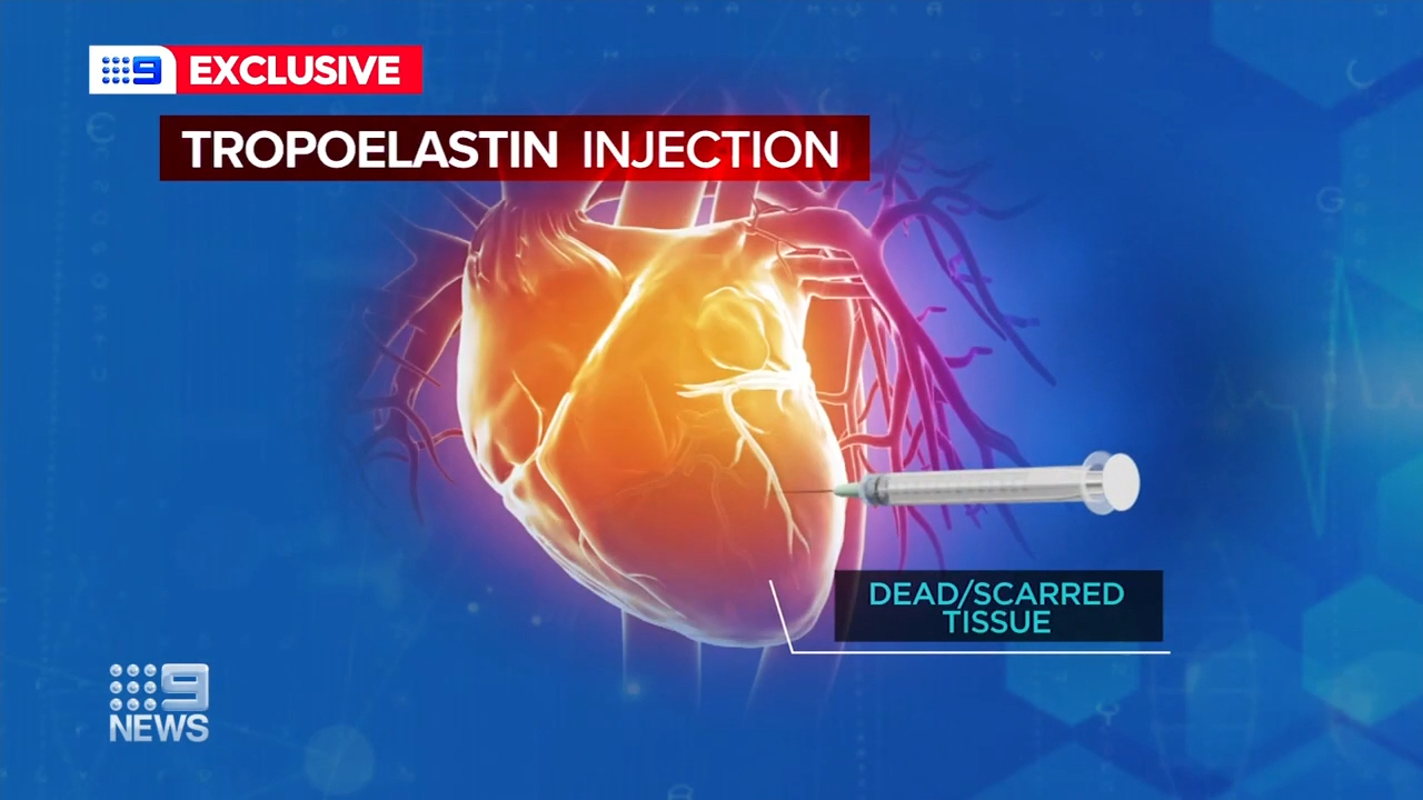 Scientists say new injection could heal long term damage from heart attacks, reducing the number of deaths for heart related diseases 