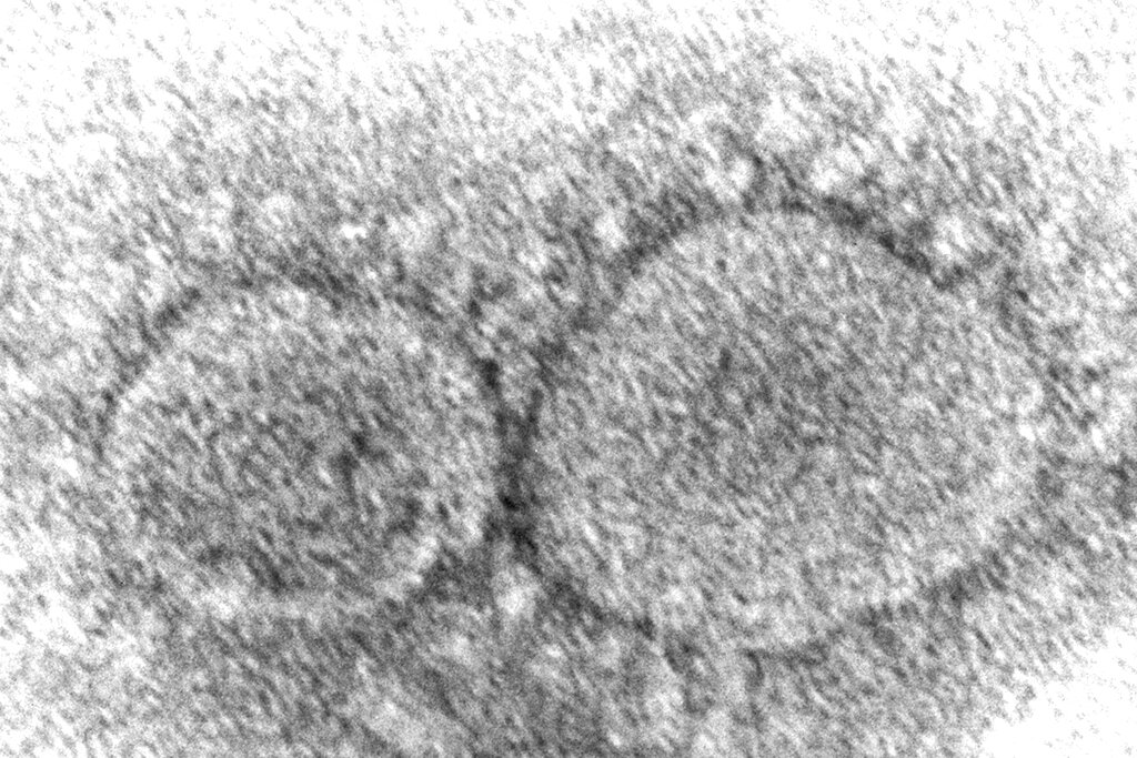 23641 Description: 	Caption: Electron microscopic image of a negatively stained particle of SARS-CoV-2, causative agent of COVID-19. Note the prominent spikes from which the coronavirus gets its name for corona, or crown-like. High Resolution: 	Click here for hi-resolution image (3.19 MB) Content Providers(s): 	CDC/ Hannah A. Bullock and Azaibi Tamin Creation Date: 	2020 Photo Credit: 	Hannah A. Bullock and Azaibi Tamin Links: 	 Categories: 	 CDC Organization