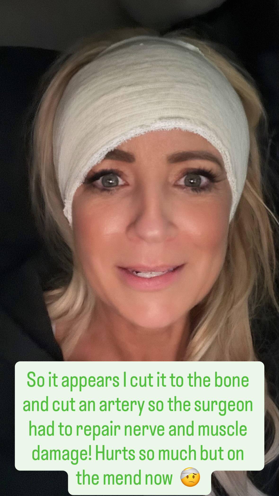 Carrie Bickmore head injury 2026