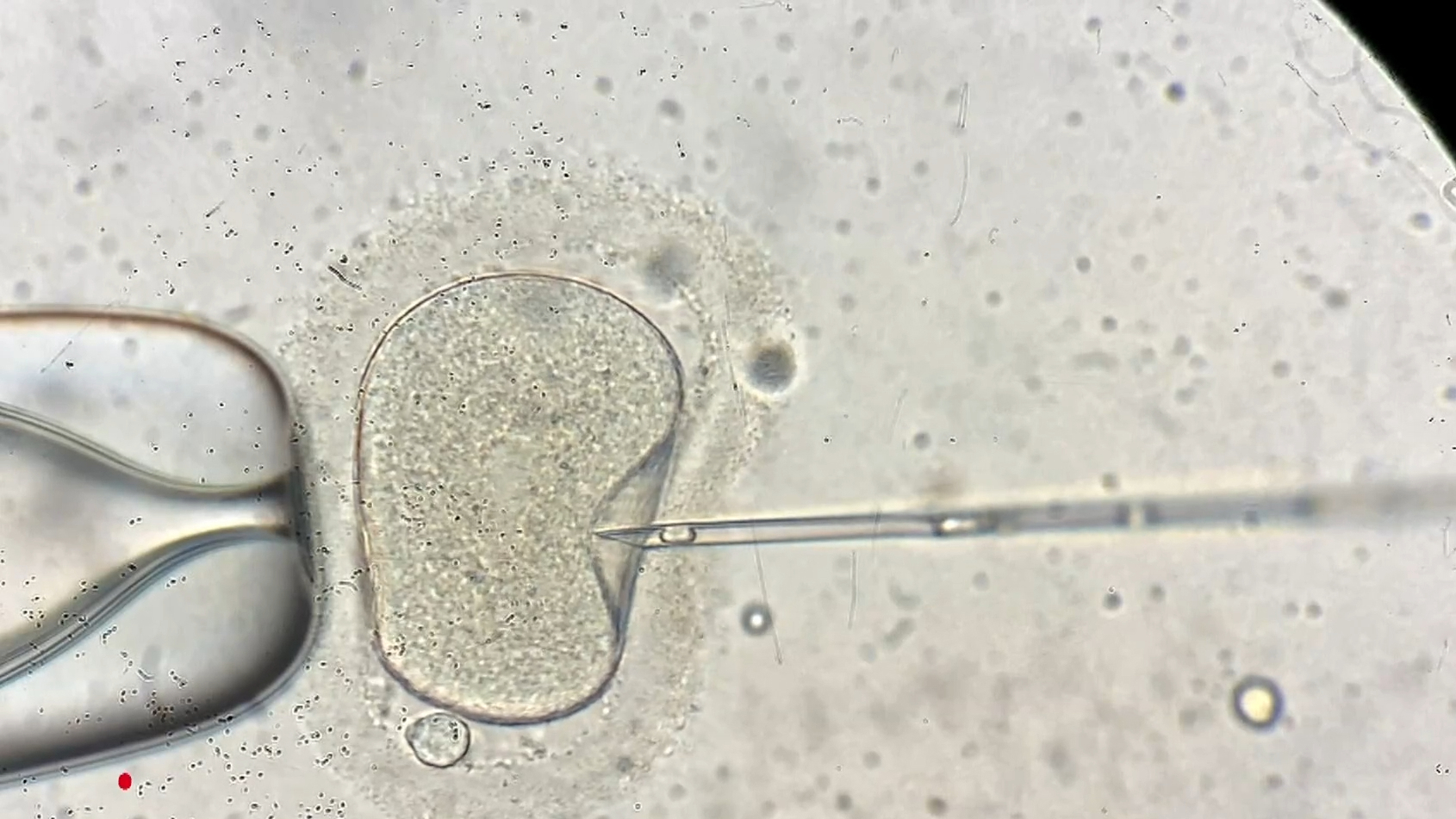 Monash IVF CEO resigns after second embryo bungle