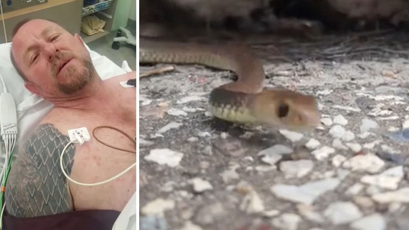 Snake Catcher's Harrowing Story Of Surviving A Brown Snake Bite