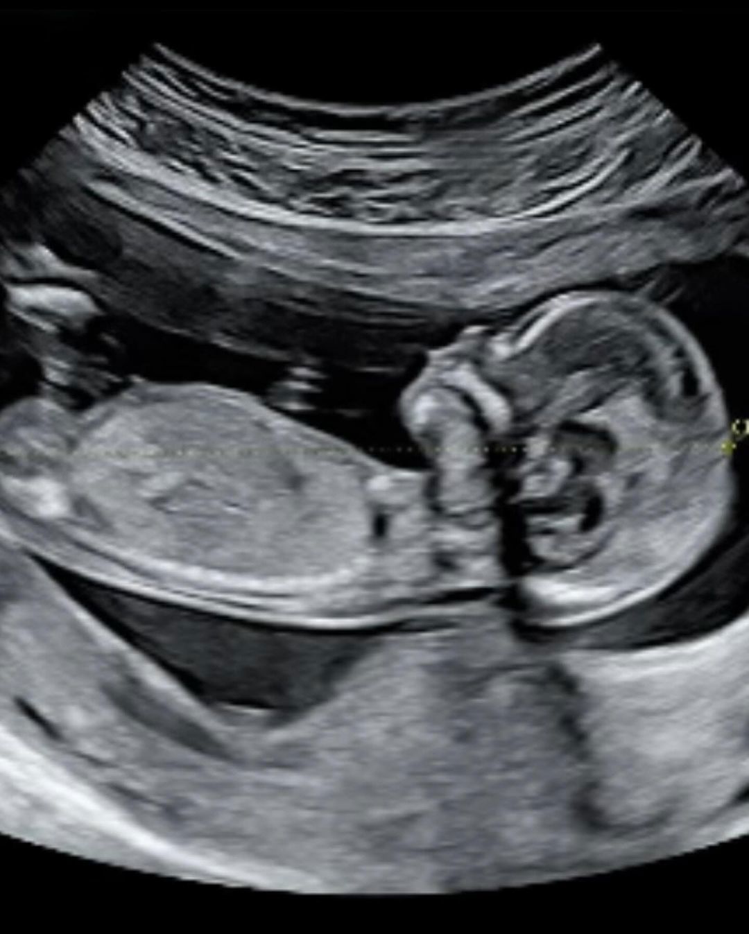 NRL star Luke Burgess and fiancee expecting second child with Tori May months after engagement