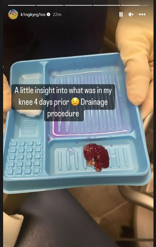 Nick Kyrgios reveals the gross extent of his knee issue.