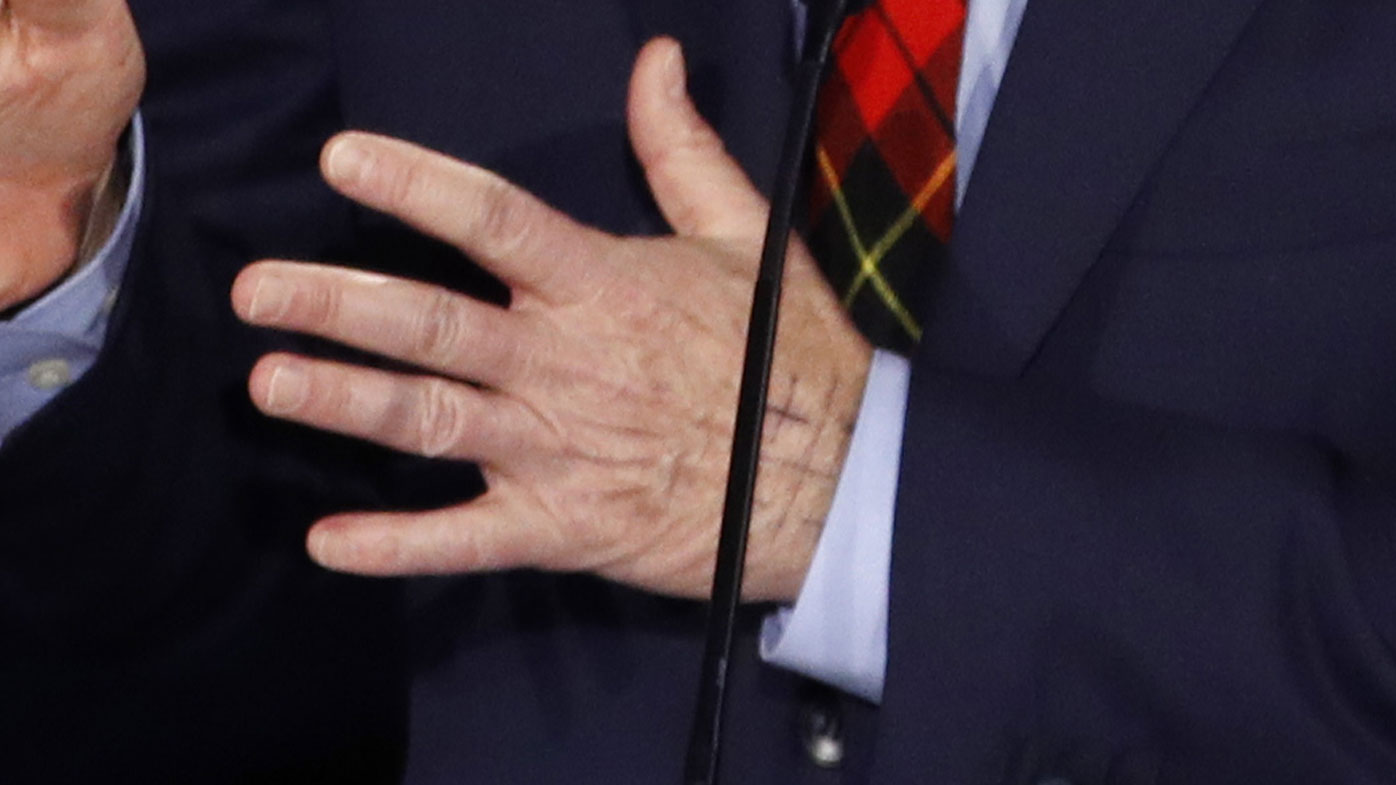 The Jerusalem Cross can be seen on Tom Steyer's hand.