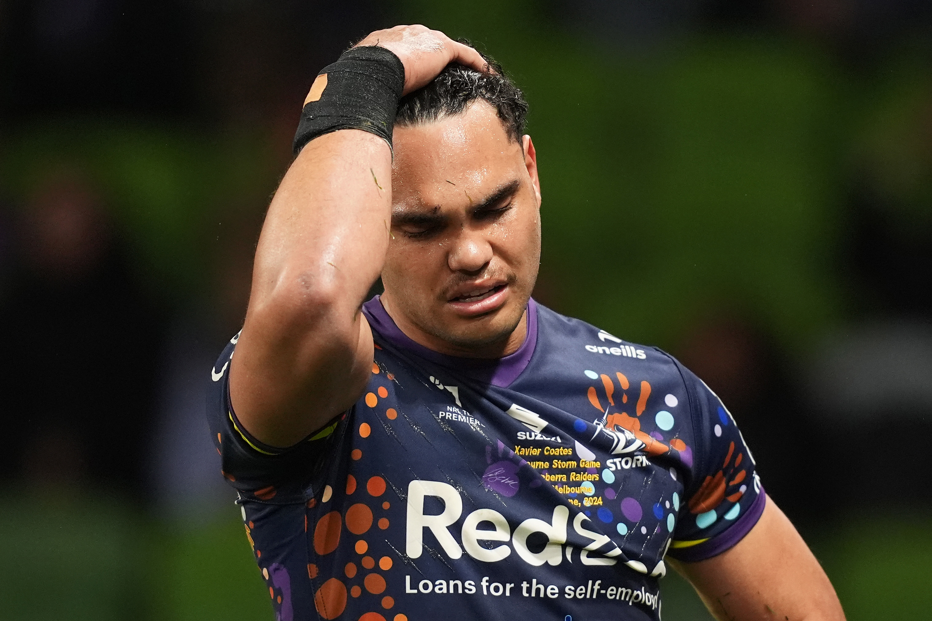 Xavier Coates of the Storm leaves the field with an injury during the round 17 NRL match between Melbourne Storm and Canberra Raiders at AAMI Park, on June 29, 2024, in Melbourne, Australia. (Photo by Daniel Pockett/Getty Images)