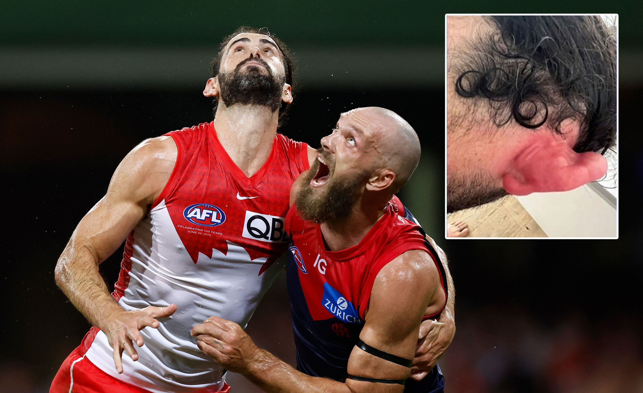 Brodie Grundy starred in his Swans debut despite being stung by a jellyfish earlier that day.