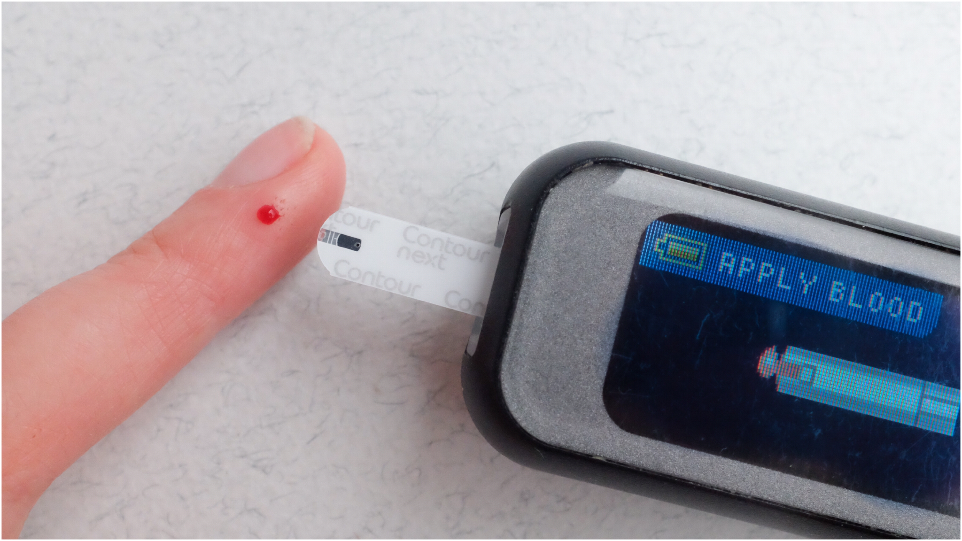 Study finds shorter people may be more susceptible to developing type II diabetes.