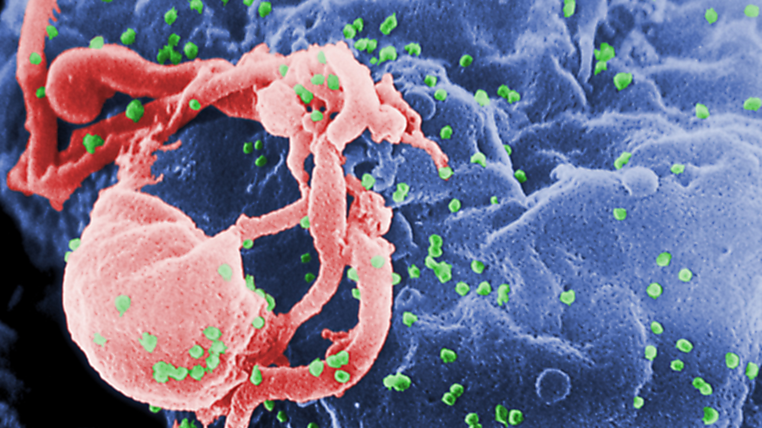 Scanning electron micrograph (SEM) of HIV-1 virions as green round bumps.