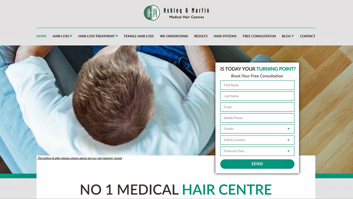 Ashley and Martin hair loss treatment ordered to refund customers side effects