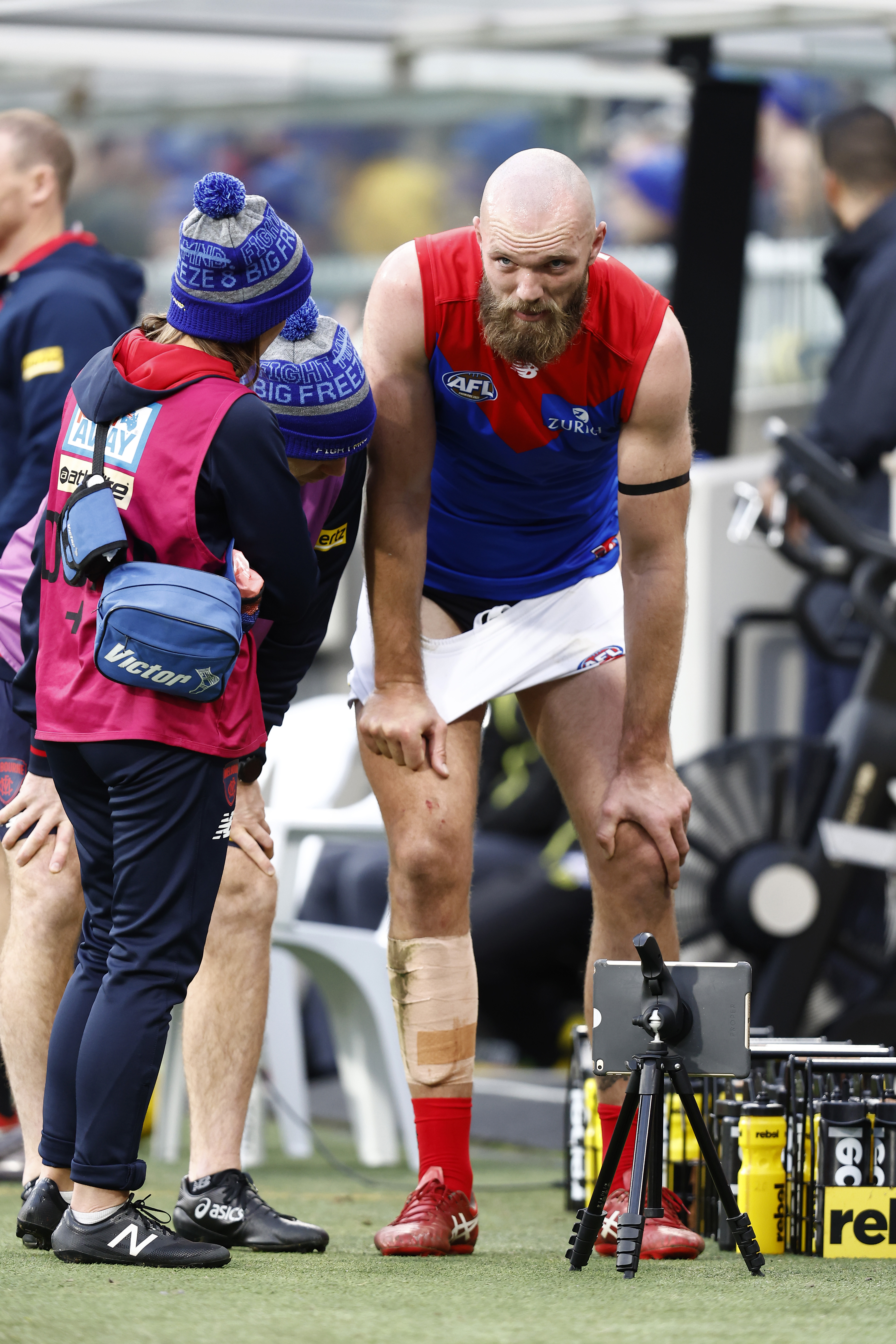 Melbourne Demons, Max Gawn absen karena cedera ankle syndesmosis