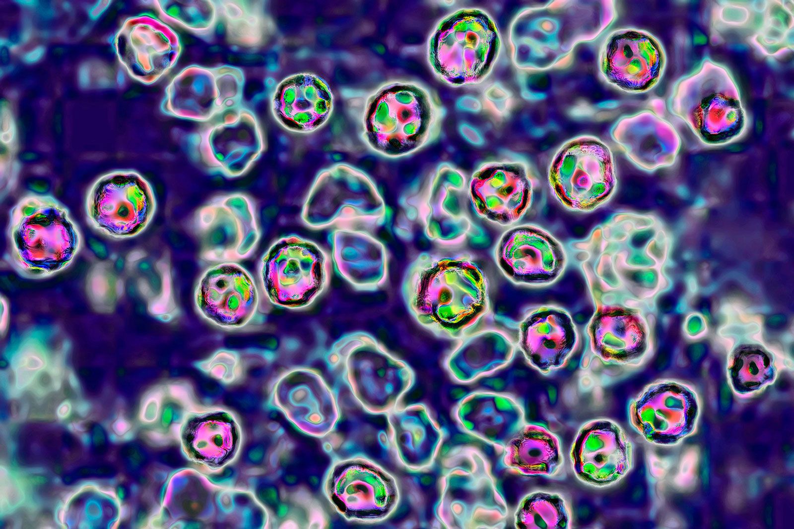 Traveller with measles was on board flight to Sydney on weekend
