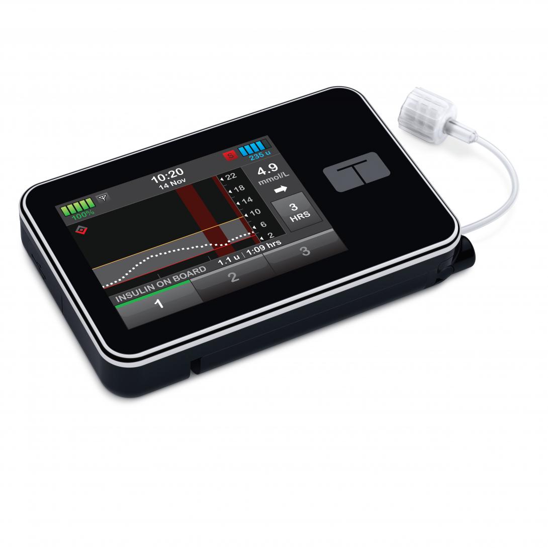 Errors affecting battery life and insulin delivery have been detected in the t:slim X2 insulin pumps from Australasian Medical and Scientific (AMSL), the Therapeutic Goods Administration said.