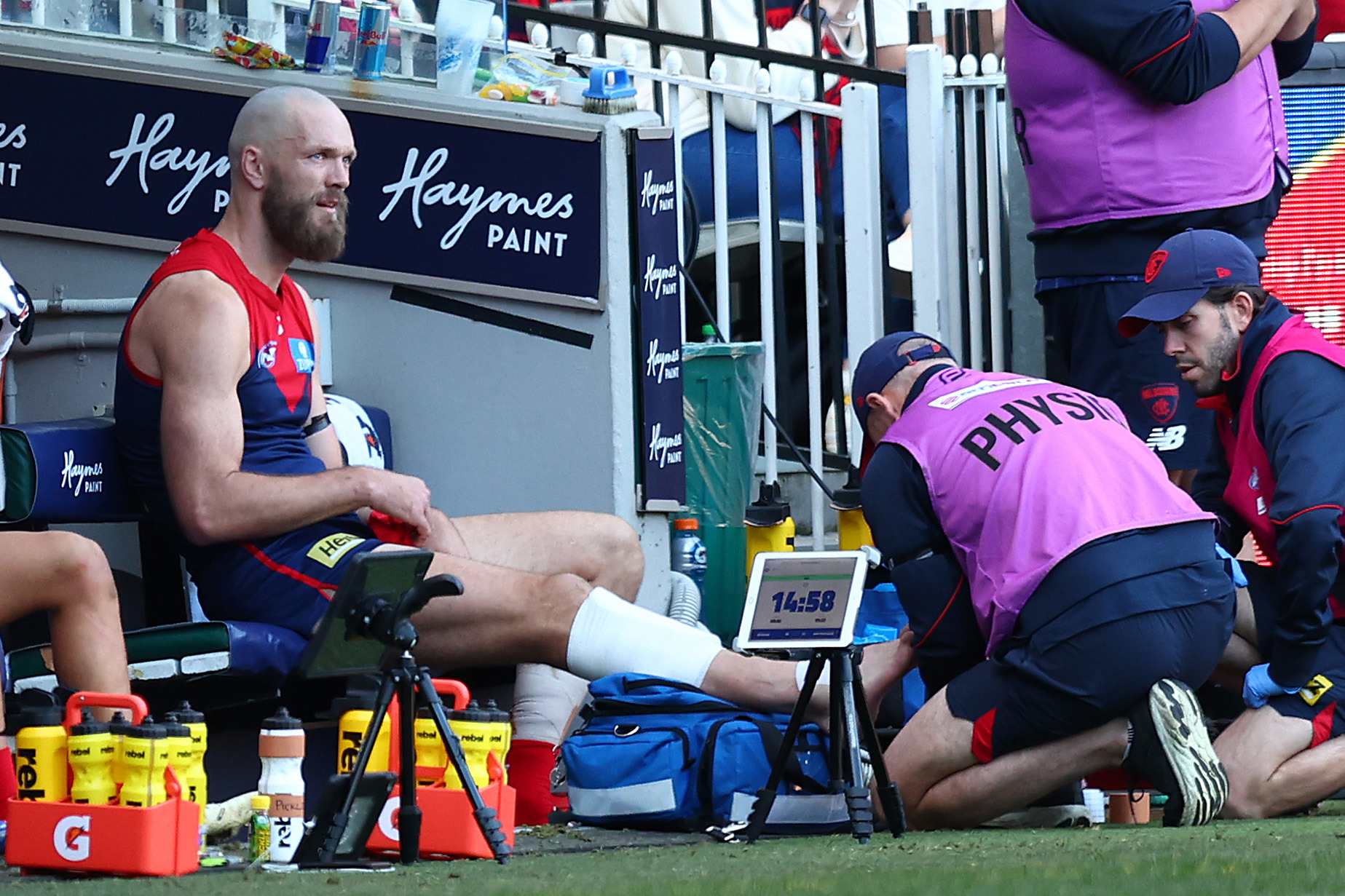 Max Gawn has a chip in his right fibula.