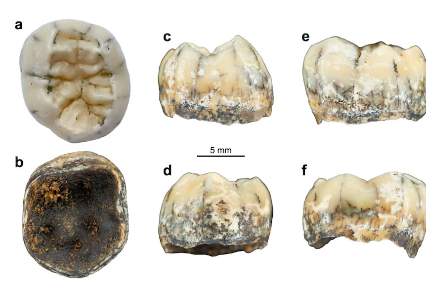 The tooth shown from top, bottom and side angles.