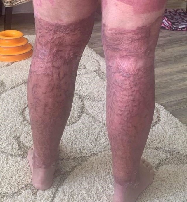 Matthew Urey white island