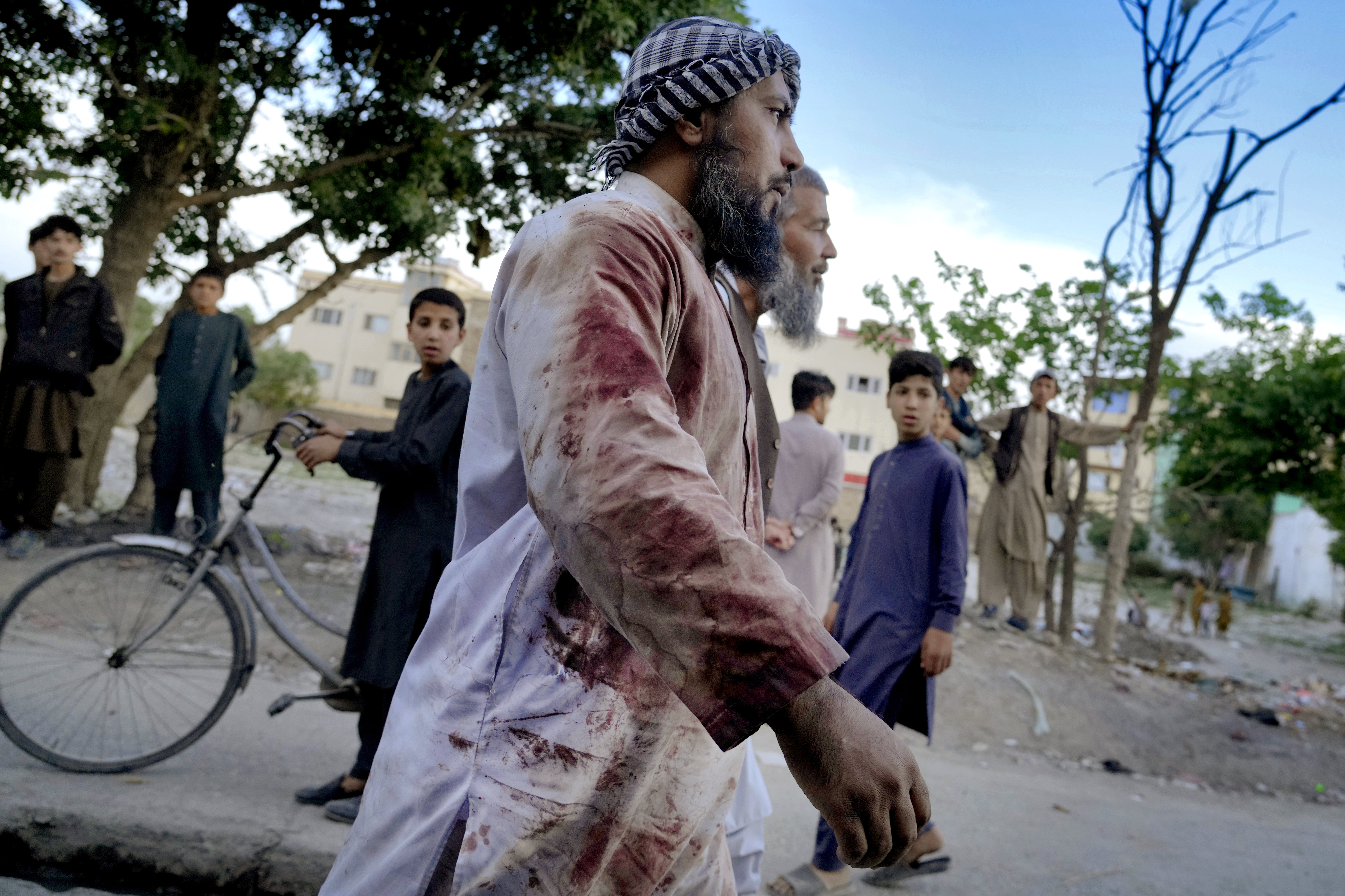 An afghan blood-stained worshiper walks around the mosque where the explosion took place, in Kabul, Afghanistan, Friday, April 29, 2022. A powerful explosion ripped through a mosque in the Afghan capital of Kabul on Friday, killing at least 10 people and wounding 20, a Taliban spokesman said. (AP Photo/Ebrahim Noroozi)