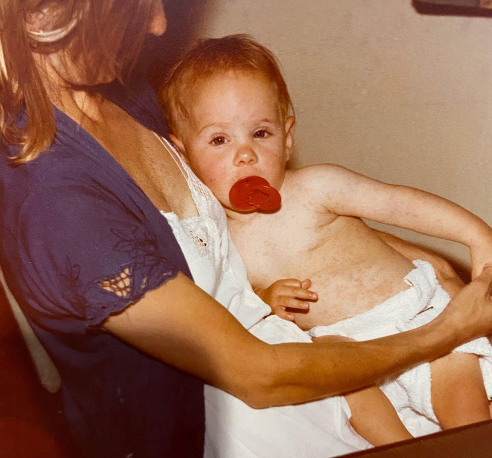 Cecily Johnson with her daughter Laine when she was ill with the measles.