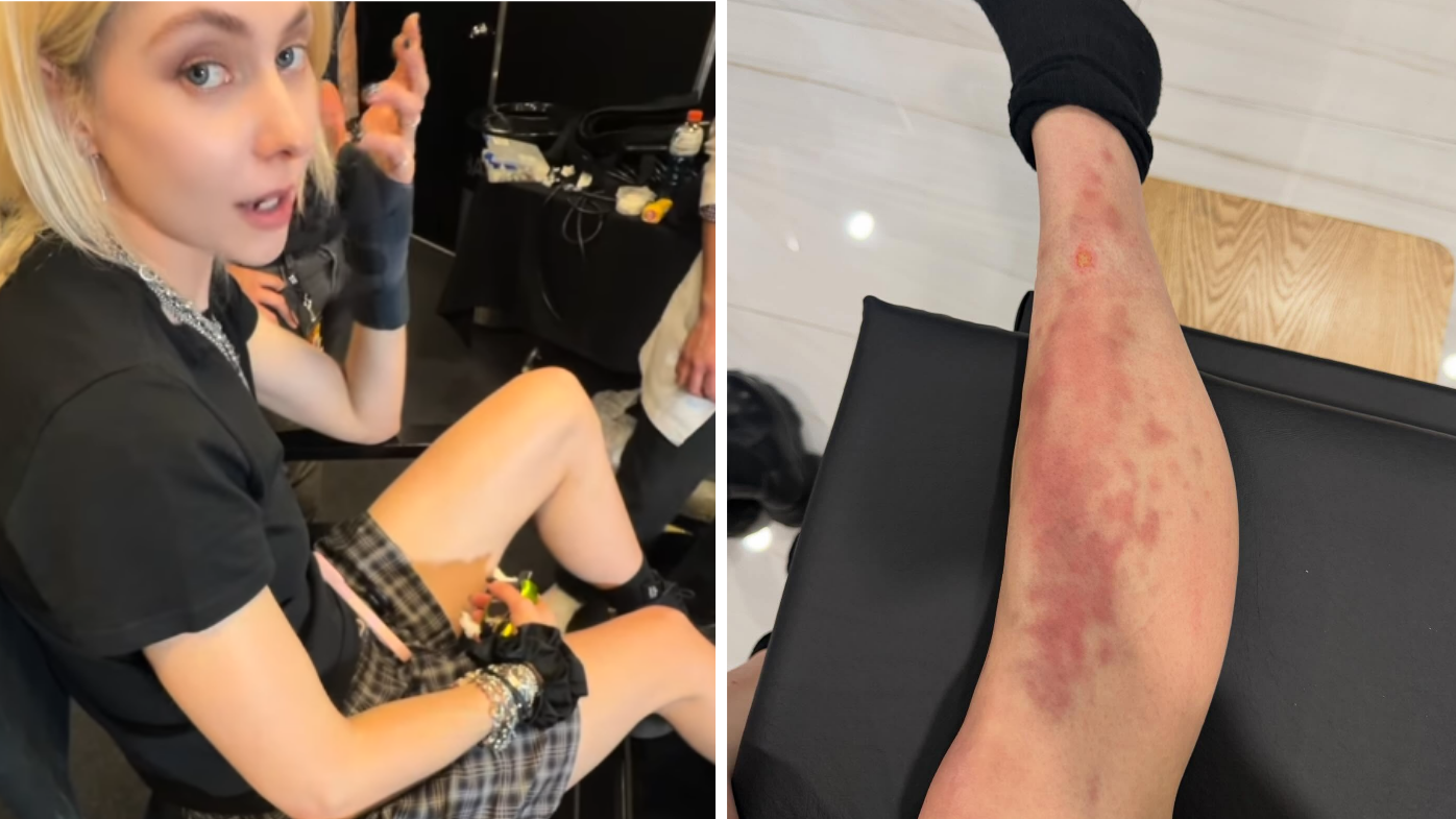 Taylor Momsen bitten by spider during AC/DC tour in Mexico