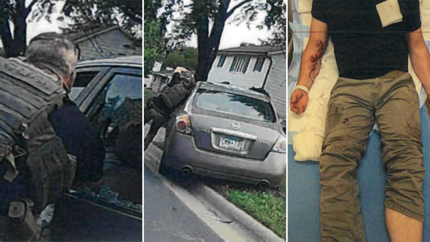 The ICE agent involved in yesterday's shooting needed dozens of stitches in a previous event.