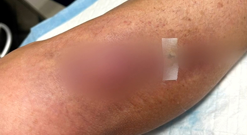 A Sydney woman was left unable to work for months after she was attacked by a kangaroo while trying to rescue a joey stuck in a fence in NSW's Blue Mountains.Melanie Stubbs, from Campbelltown, had been hiking in the Megalong Valley near Katoomba with friends in December when the group spotted a joey hanging from a wire fence by its back legs.