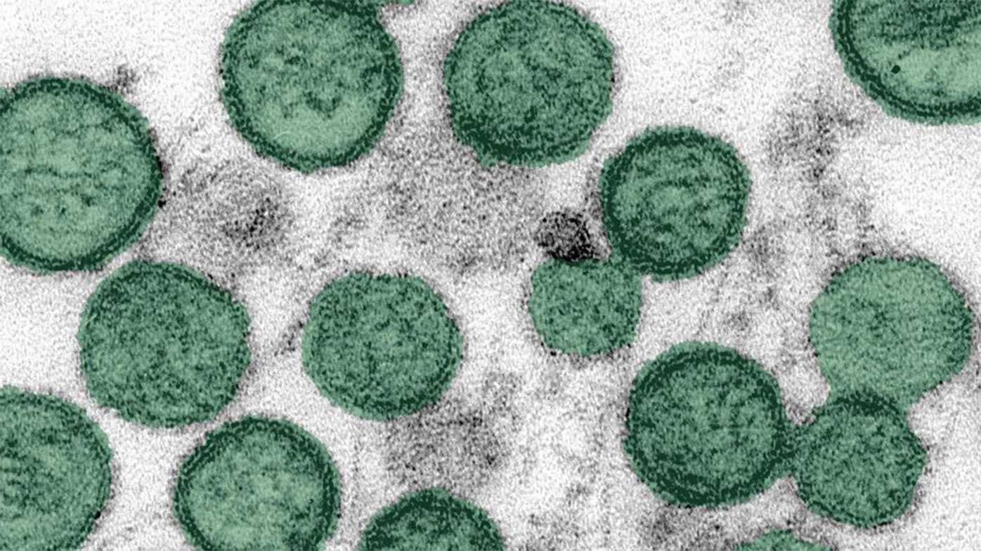 The hantavirus as seen under a microscope.