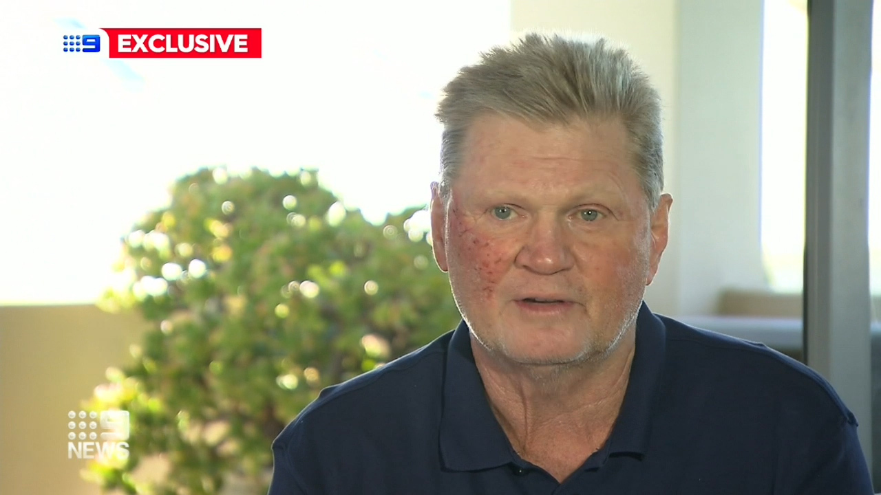 Paul 'Fatty' Vautin reveals skin cancer scare - Flipboard