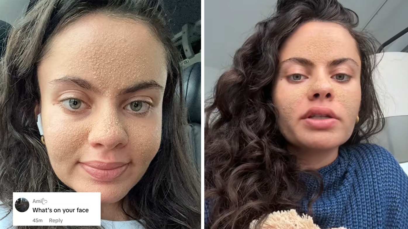 Tia Zakher has amassed more than 50 million views across several videos about her skin's reaction to the 'caveman method'.