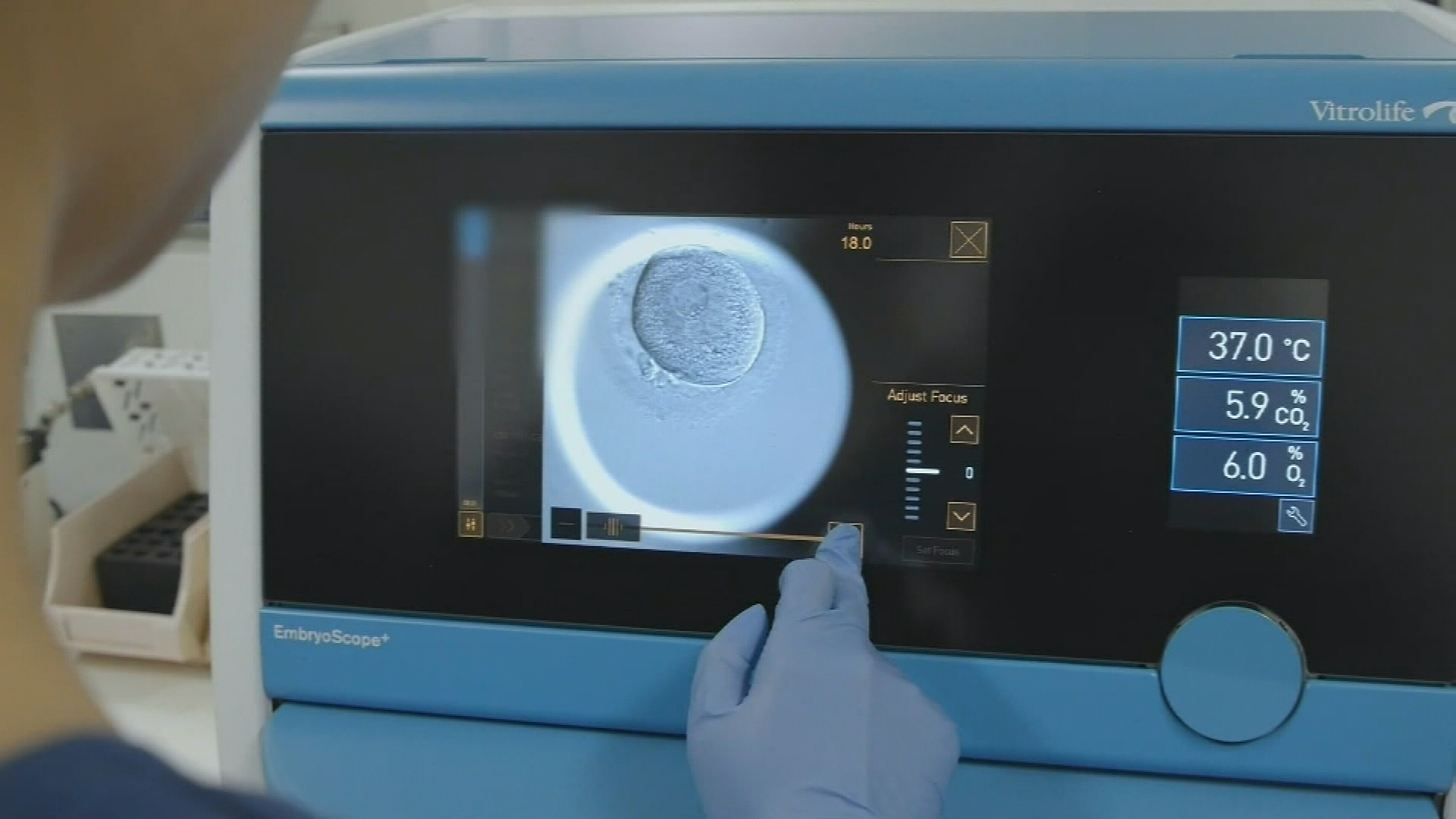 IVF TREATEMENTS 