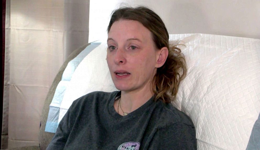 Brittany Parker was attacked by a pet monkey in Oklaholma.