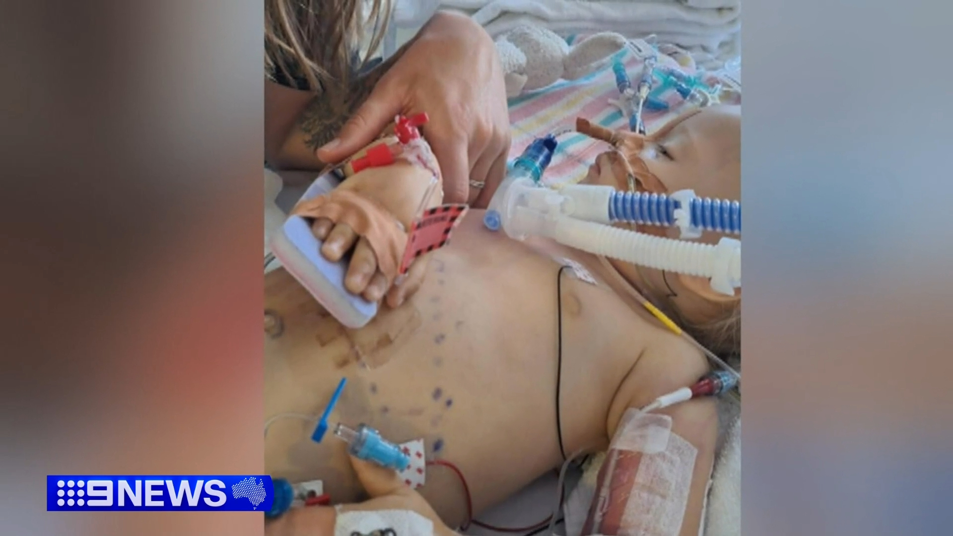 Australian medical professionals have issued an urgent warning to parents following a sharp rise in the number of young children swallowing button batteries. 