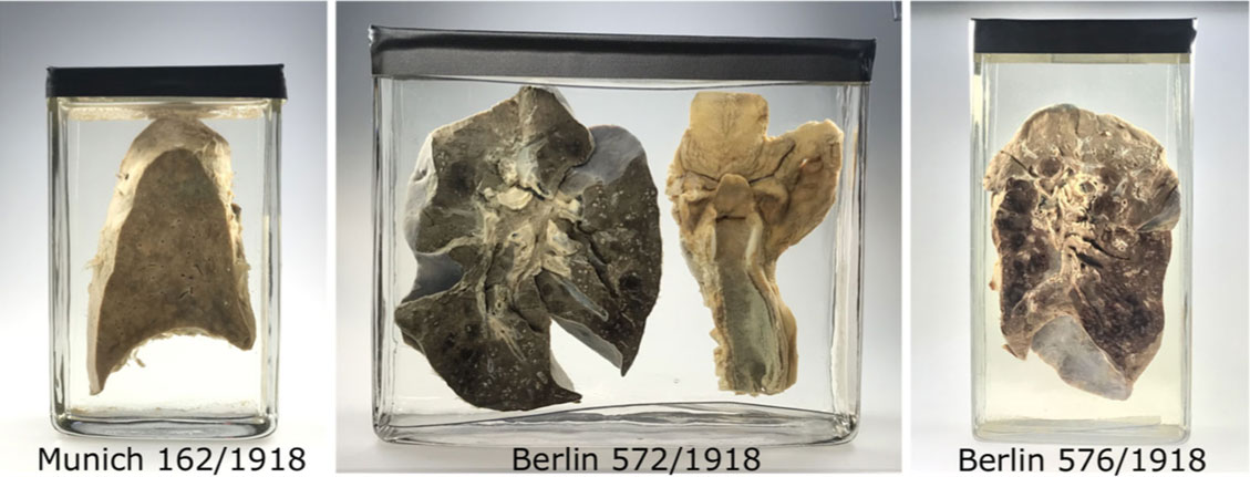 Scientists analysed 13 lung specimens stored in German and Austrian museums, including six samples collected in 1918 and 1919 during the peak of the Spanish Flu pandemic.