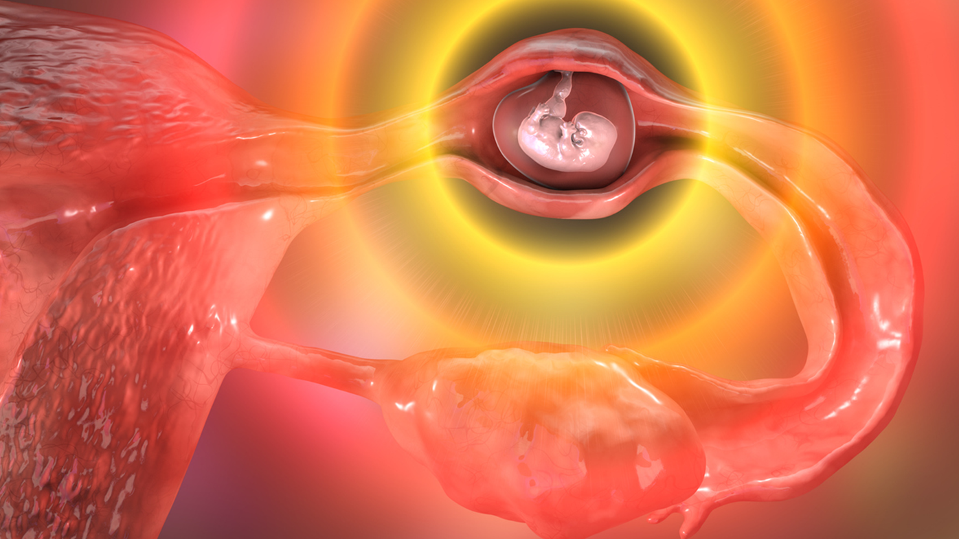 An ectopic pregnancy occurs when a fetus develops outside the uterus, typically in a fallopian tube. They are life-threatening for the mother, and always end in pregnancy loss. 