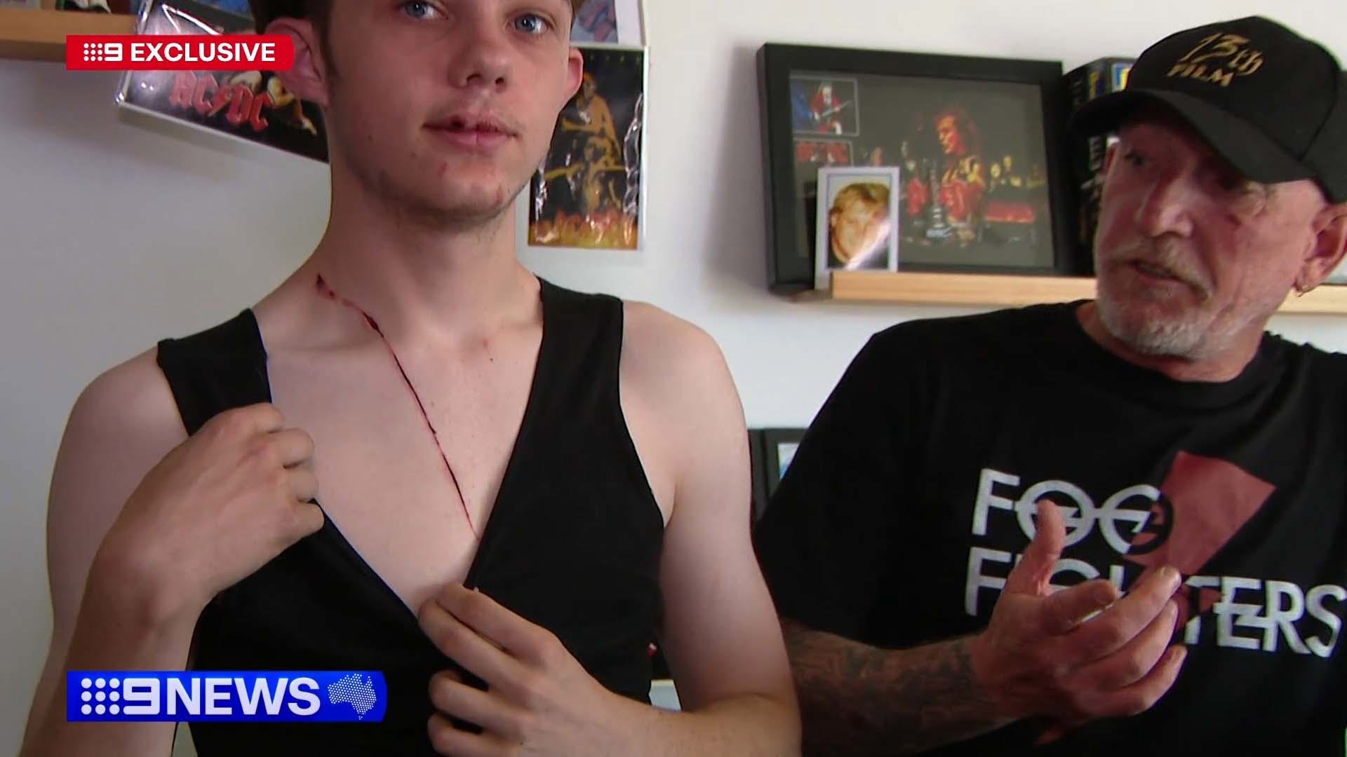 Battered and bruised after a frightening break in erupted into violence, Chris Abrook is glad he put up a fight.