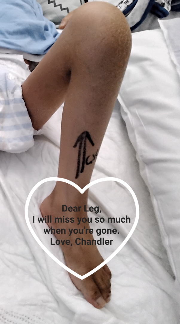 Chandler Tran from Sydney's west has bone cancer.