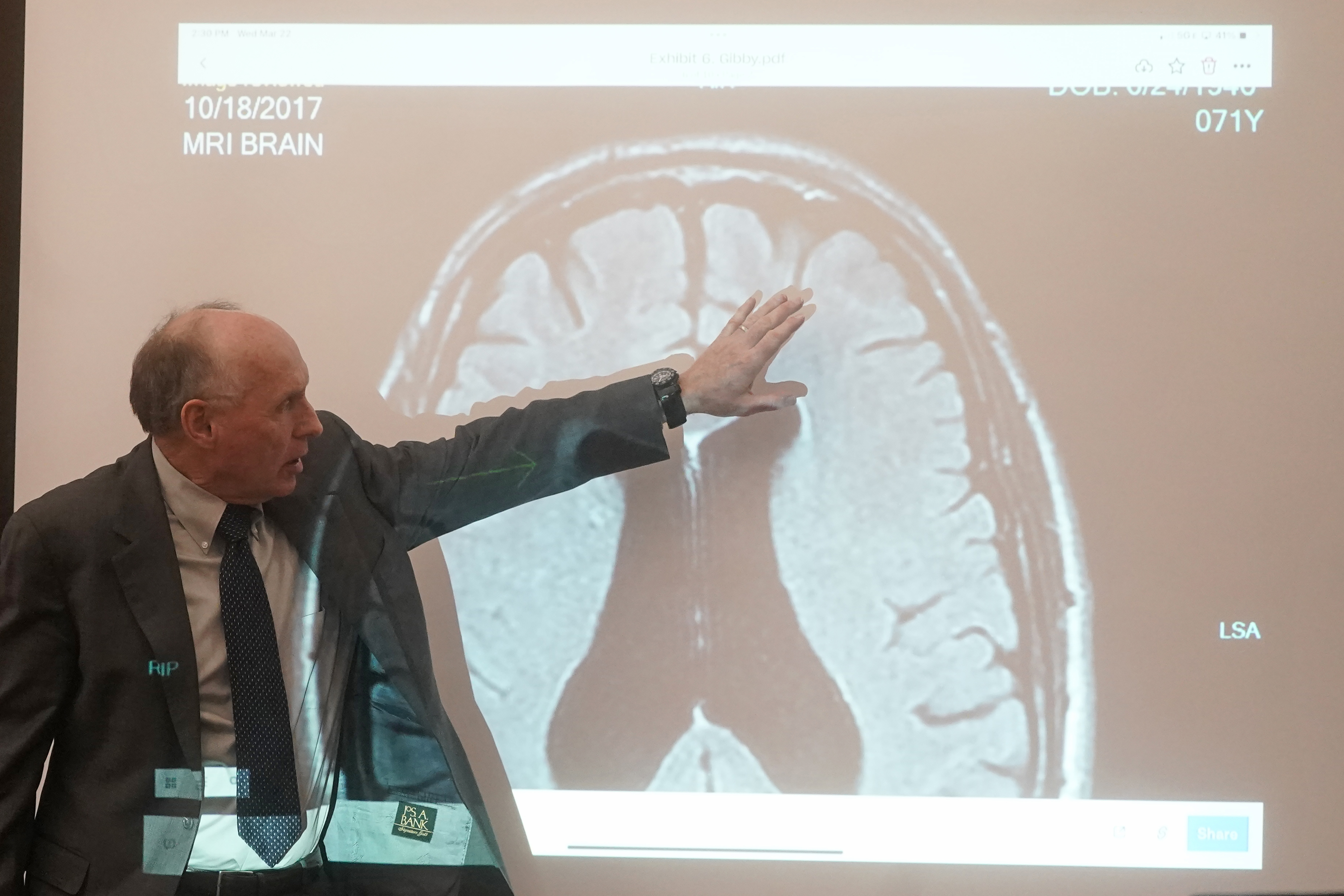 El Dr. Wendell Gibby describe una resonancia magnética que muestra el cerebro del hombre que demandó a Gwyneth Paltrow por una colisión de esquí en 2016, el miércoles 22 de marzo de 2023, en Park City, Utah.  Gibby, un radiólogo, dijo que el traumatismo craneal de Sanderson probablemente fue causado por un esquiador que chocó contra él.  (Foto AP/Rick Bowmer, Piscina)