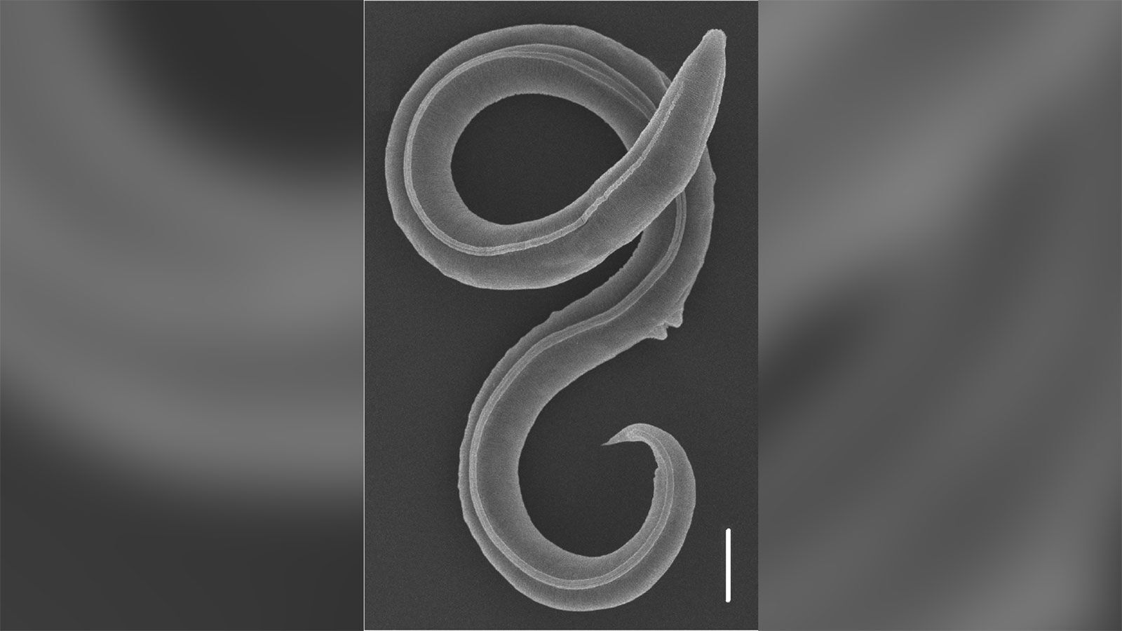 Microscopic image of worm found in Siberian permafrost.